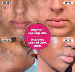 Dark Spot Correcting Glow Serum